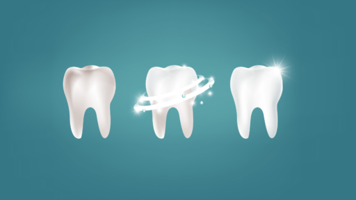 Schutz des Zahnschmelzes